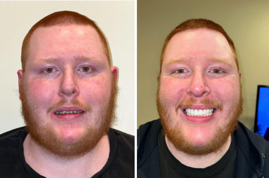 The image displays three separate photographs of a man with a beard, showcasing different facial expressions and hairstyles.