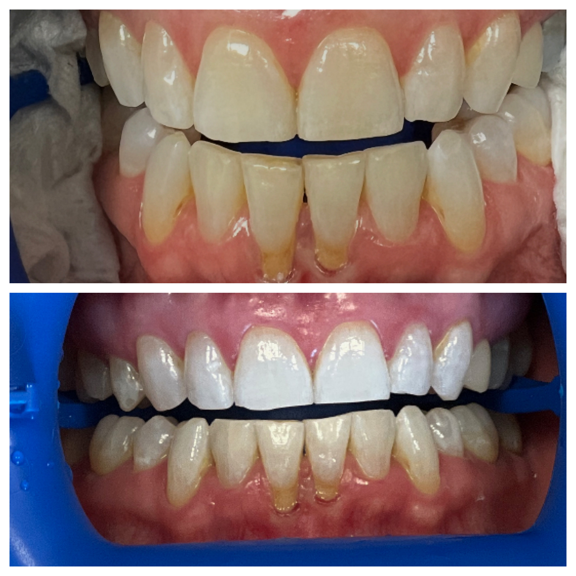Smile Studio Shartel | Restorative Dentistry, ZOOM  Whitening and Intraoral Camera