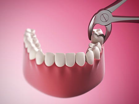 The image shows a pair of pliers adjusting a dental implant with a tooth-like prosthetic in place, set against a pink background.