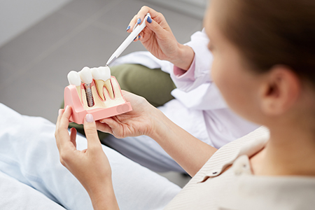 Smile Studio Shartel | Cosmetic Dentistry, Digital Impressions and All-on-4 reg 